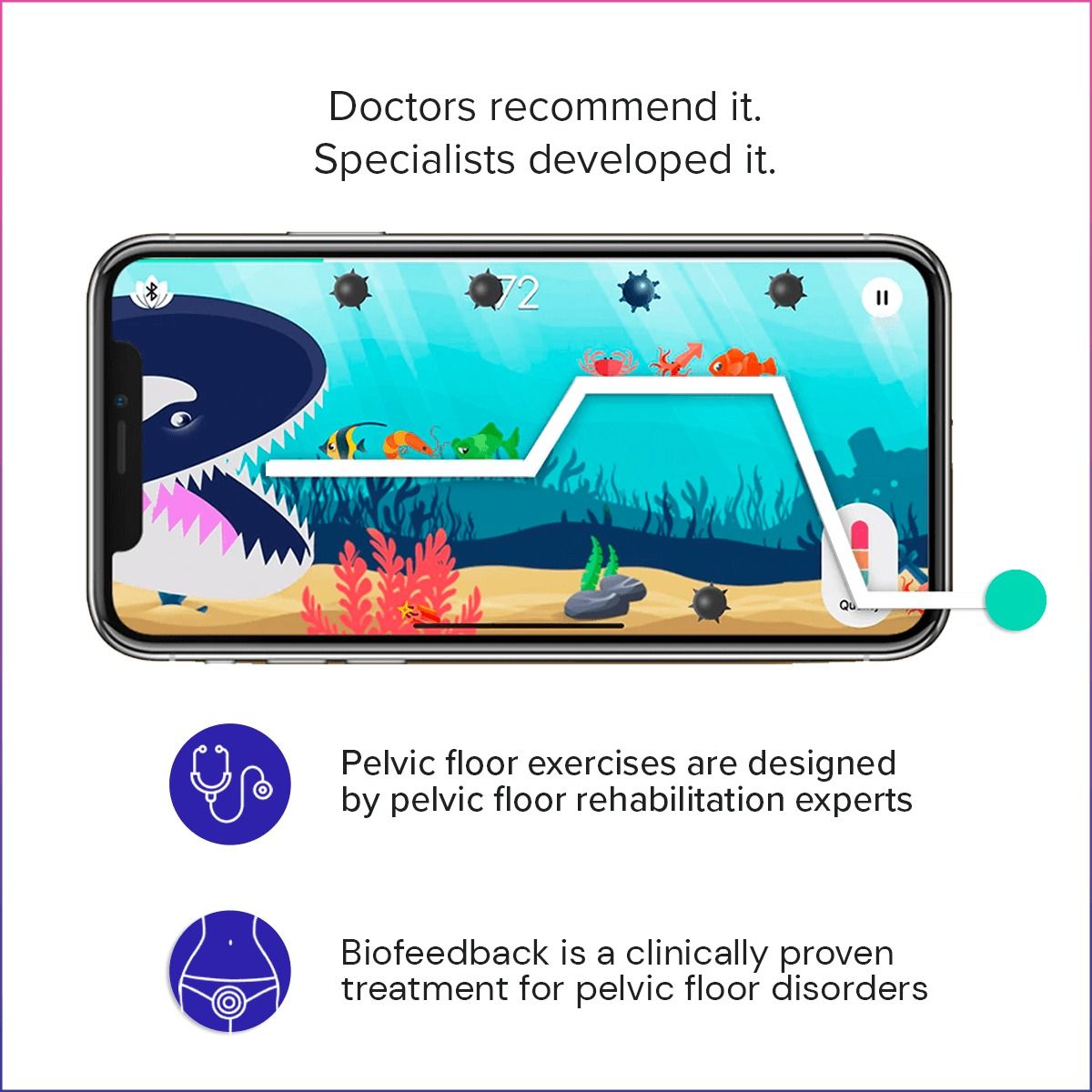 Perifit Care+ Dynamische Kegel-oefenapparaat - Lila